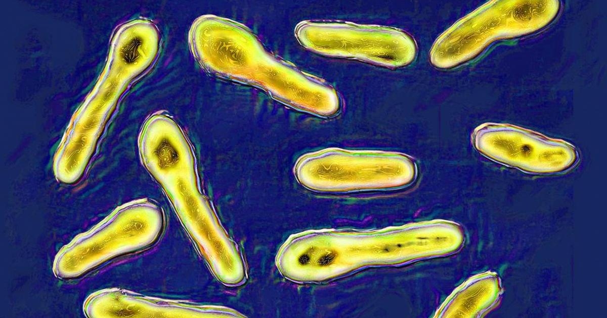 Intoxicación por botulismo: así se desarrolla. Síntomas y tratamientos.