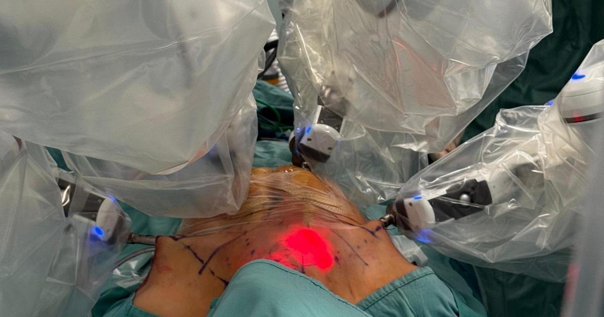 Роботизированная операция на щитовидной железе без рубцов впервые в Италии в больнице Джемелли