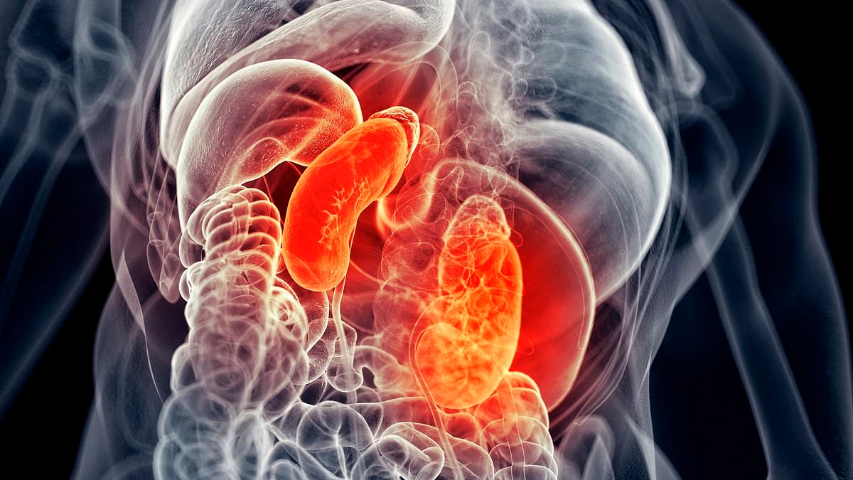 Chronic kidney disease has more than DOUBLED since 1990 to 800 million, experts discover: 'It's a growing global health crisis'
