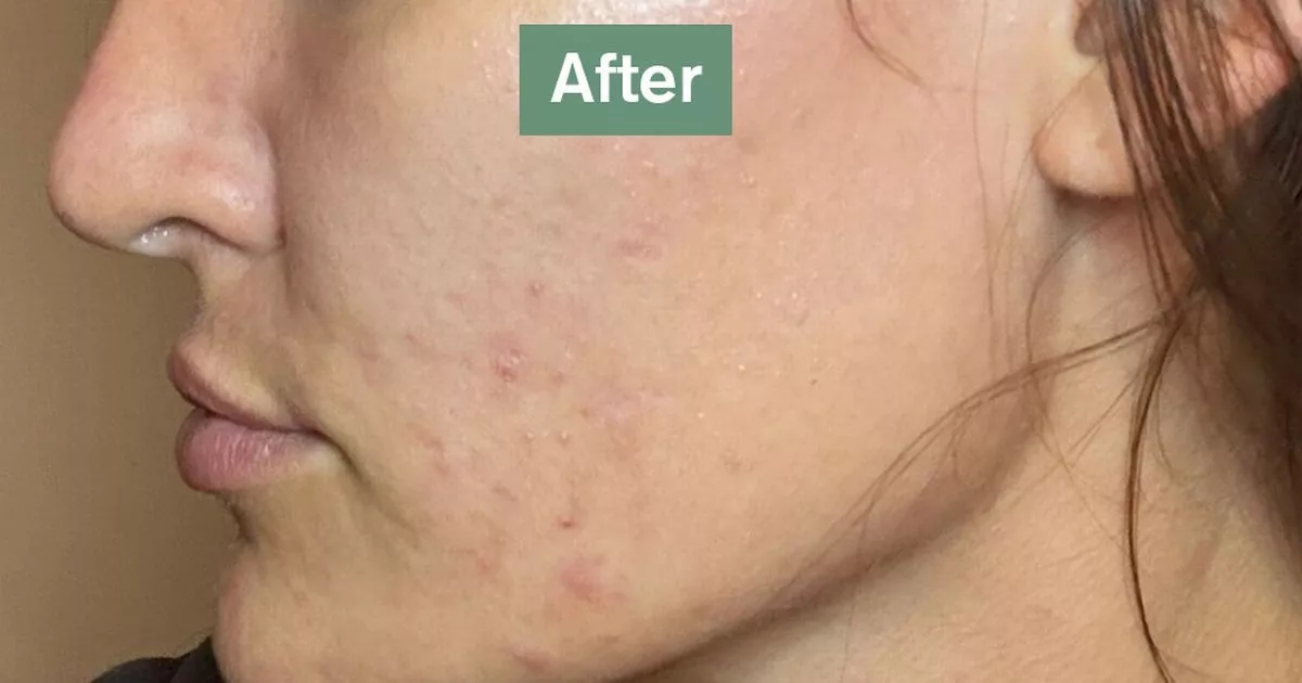 Таблетки по 61 пенсу в день уменьшают «морщины» и «мешки под глазами исчезают» у покупателей