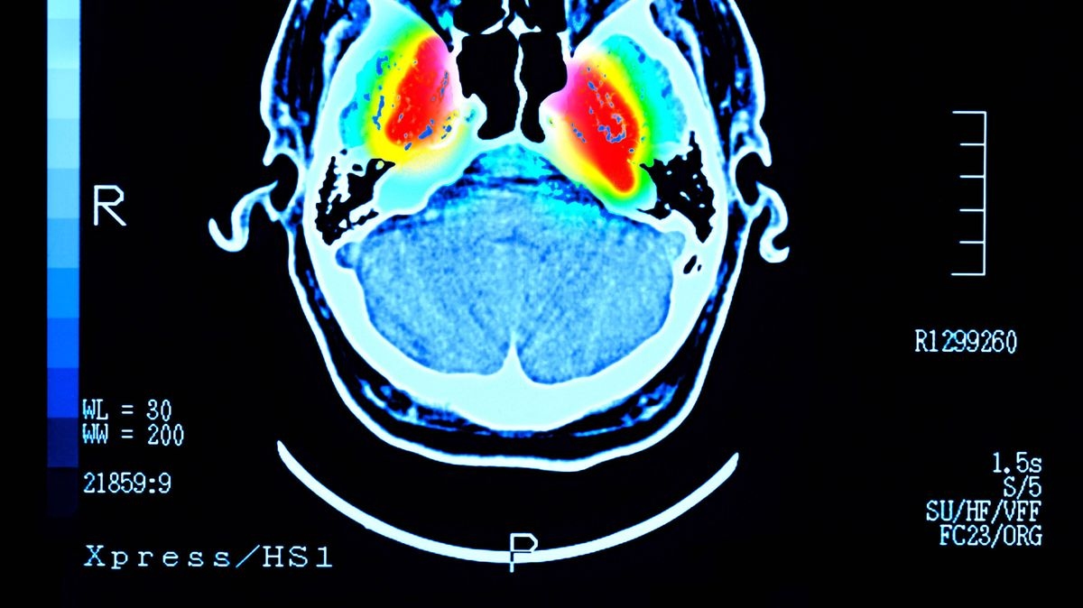 Daily 'fountain of youth' drink could lower dementia and diabetes risk