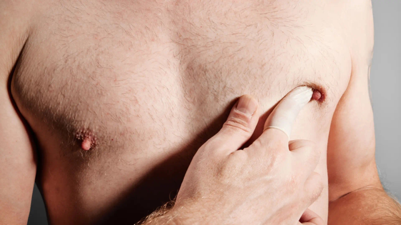Gli uomini con tumore al seno raccomandano l'autopalpazione per evitare diagnosi tardive