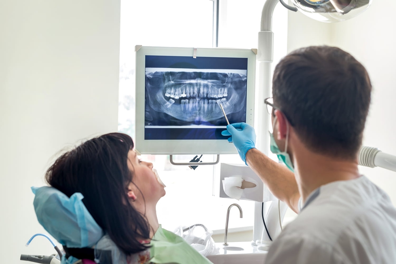 Los dentistas advierten: las personas con estos problemas dentales tienen "casi el doble de riesgo de sufrir un derrame cerebral"