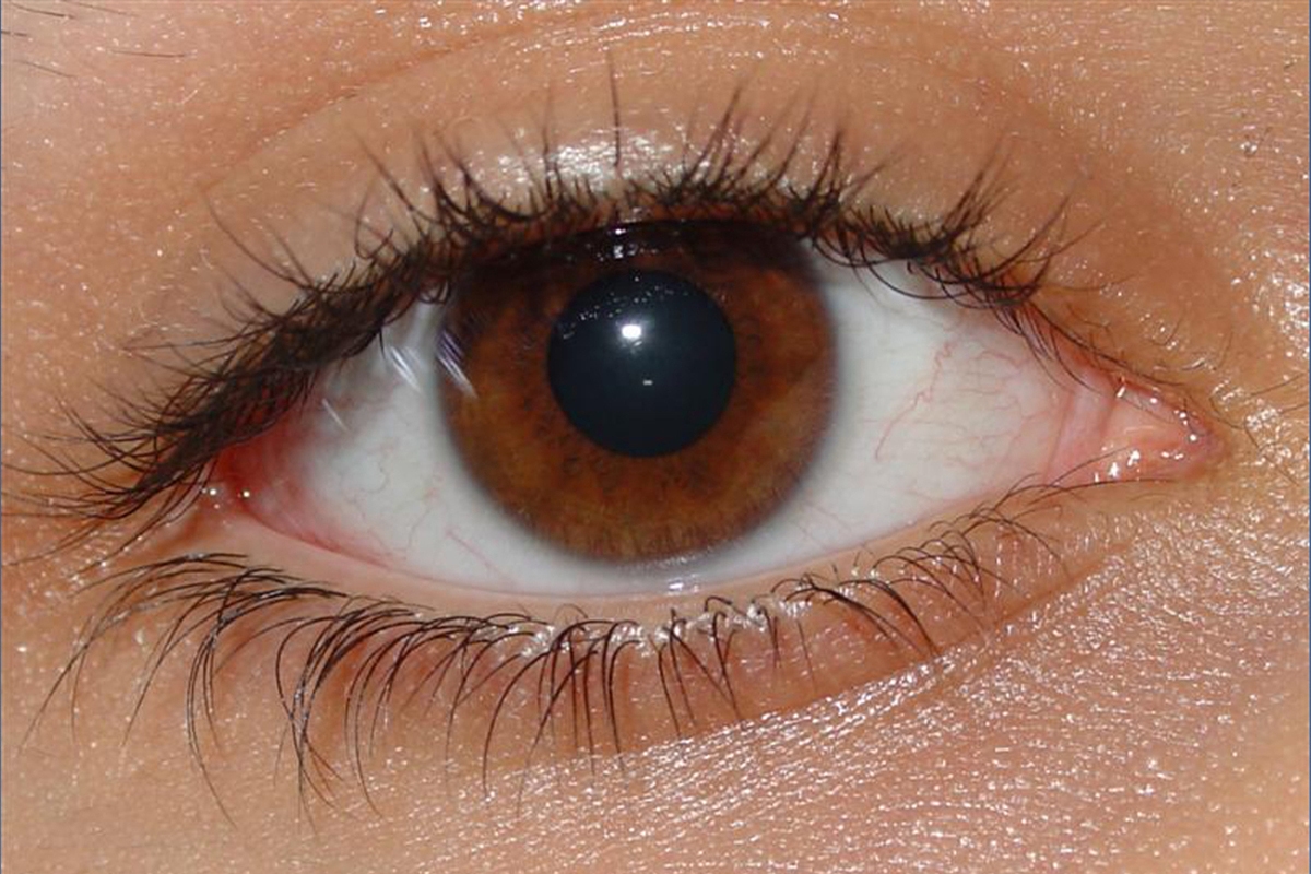 Sztuczna inteligencja pozwoli na diagnozowanie zaburzeń psychicznych za pomocą siatkówki.