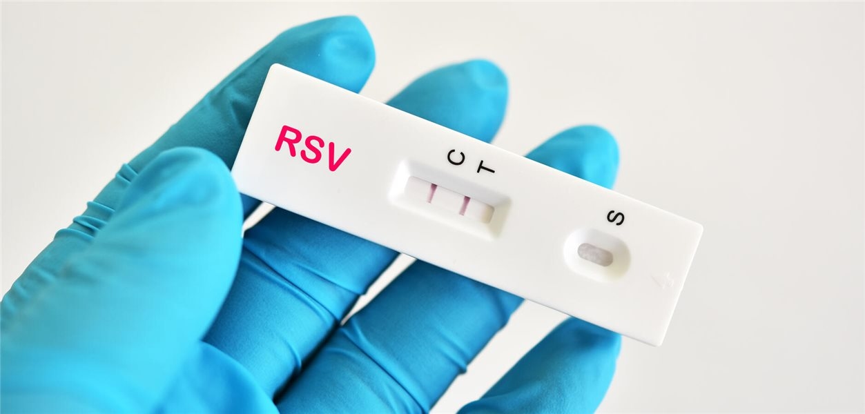 Ambulante Antibiotikaverordnungen bei Kindern einsparen mit RSV-Schnelltests?